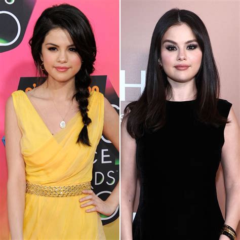 Selena Gomez Breast Implants Photos [Before & After]